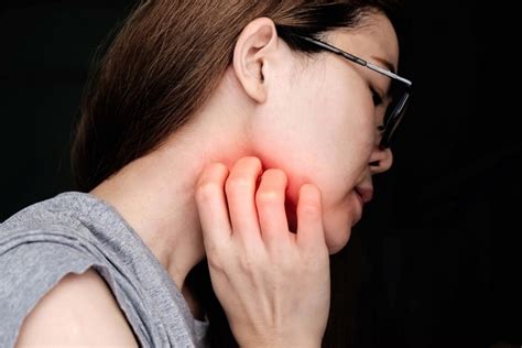 itchy chin and jawline hormonal|itchy chin in women.